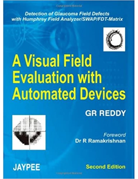 A Visual Field Evaluation with Automated Devices