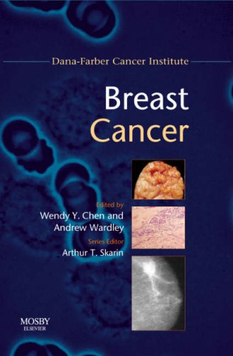 Breast Cancer - Dana-Farber Cancer Institute Handbook