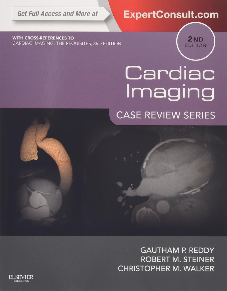 Cardiac Imaging: Case Review Series