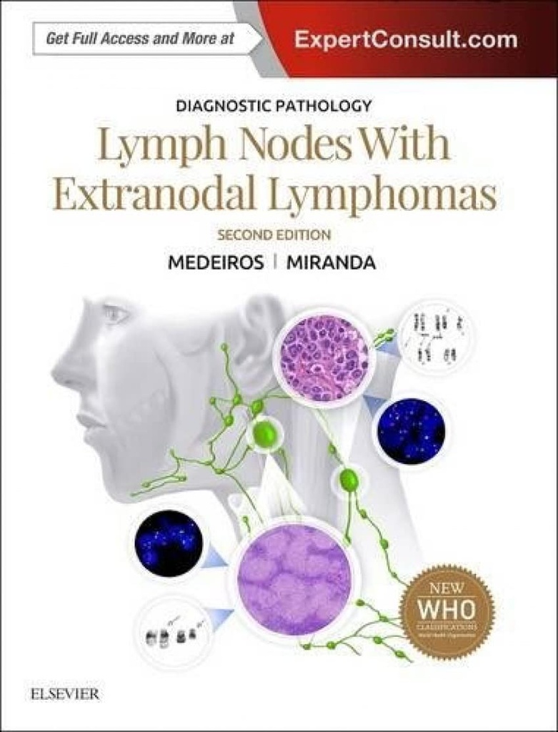 Diagnostic Pathology: Lymph Nodes and Extranodal Lymphomas