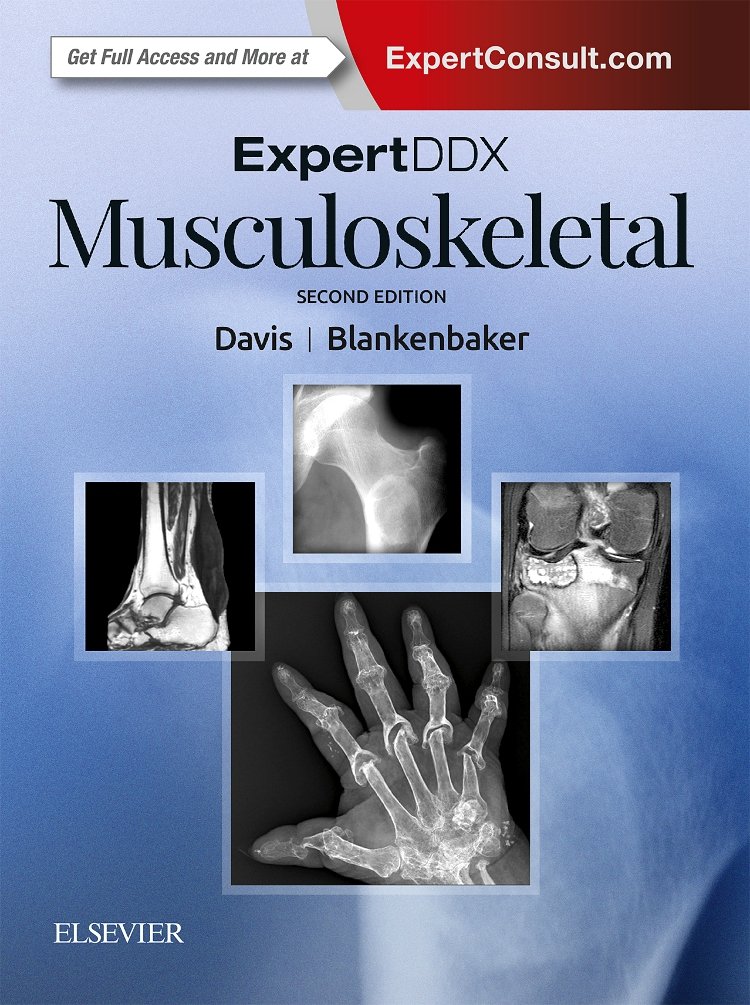 ExpertDDX: Musculoskeletal