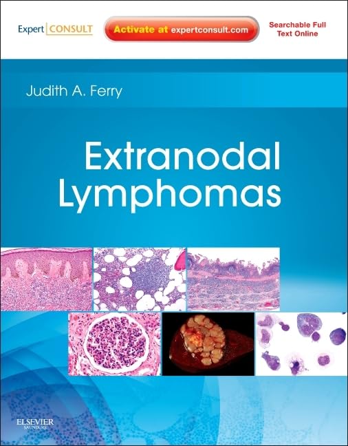 Extranodal Lymphomas