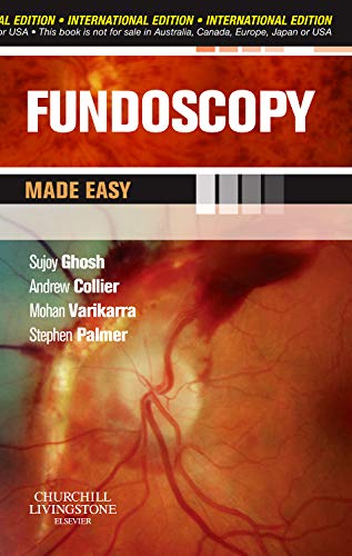 Fundoscopy Made Easy 