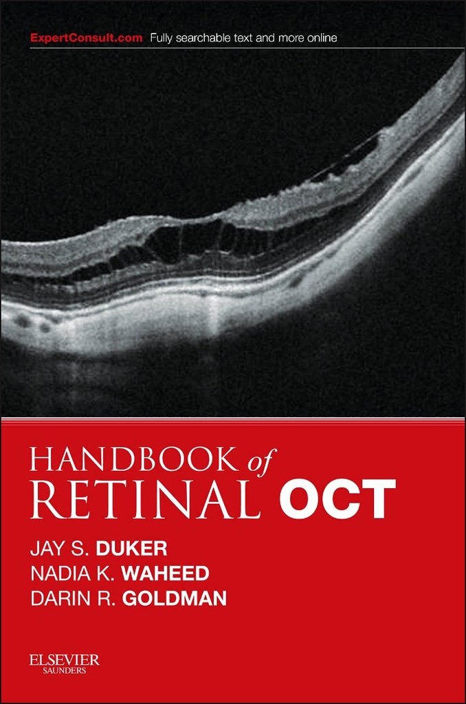 Handbook of Retinal OCT: Optical Coherence Tomography