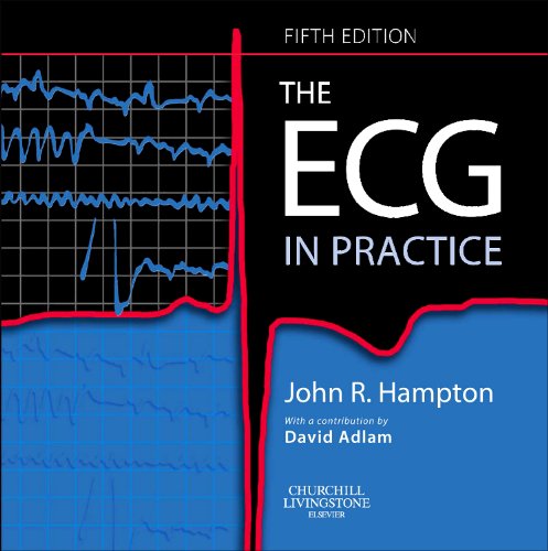 The ECG In Practice 5E