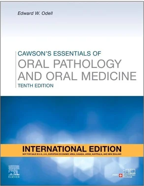 Cawson's Essentials of Oral Pathology and Oral Medicine 10E