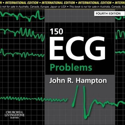 150 ECG Problems 4E