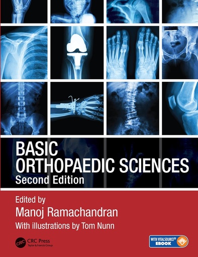 Basic Orthopaedic Sciences 