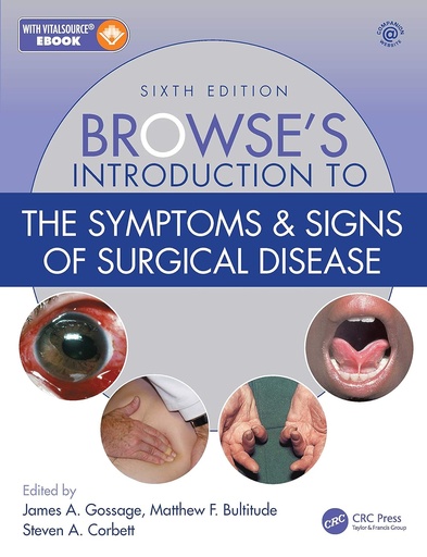 Browse's Introduction to the Symptoms and Signs of Surgical Disease 6E