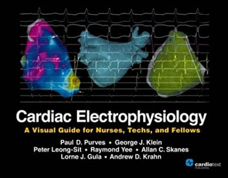 Cardiac Electrophysiology: A Visual Guide for Nurses, Techs and Fellows