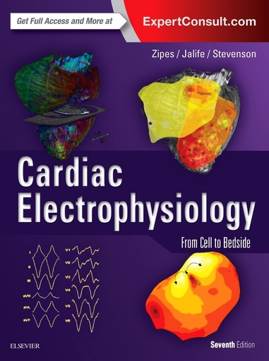 Cardiac Electrophysiology: From Cell to Bedside 7E