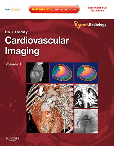 Cardiovascular Imaging 2 Vol