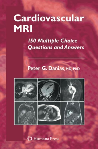 Cardiovascular MRI: 150 Multiple-Choice Questions and Answers