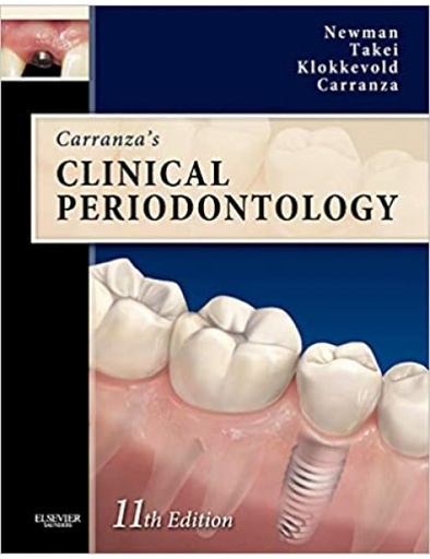 Carranza's Clinical Periodontology