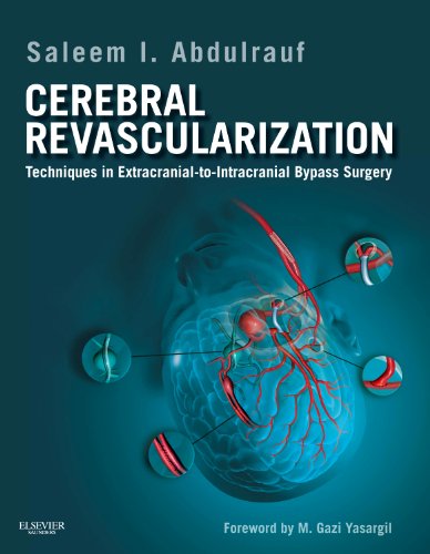 Cerebral Revascularization: Techniques in Extracranial to Intracranial Bypass Surgery