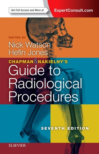 Chapman and Nakielny's Guide to Radiological Procedures