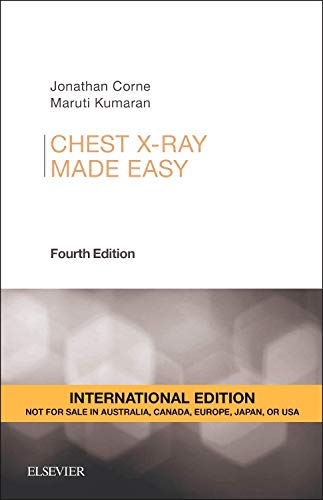 Chest X-Ray Made Easy (4E)