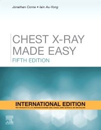 Chest X-Ray Made Easy (5E)