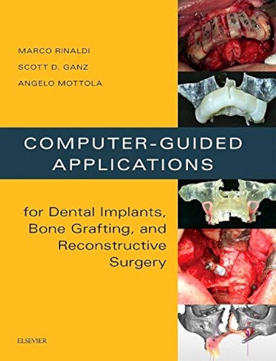 Computer - Guided Applications for Dental Implants, Bone Grafting, and Reconstructive Surgery