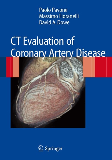 CT Evaluation of Coronary Artery Disease