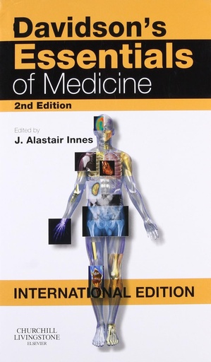 Davidson's Essentials of Medicine 2E