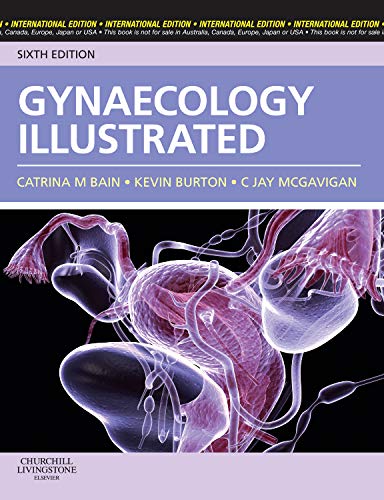 Gynaecology Illustrated