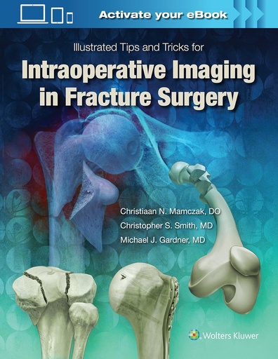 [Wolters Kluwer Health] Illustrated Tips and Tricks for Intraoperative Imaging in Fracture Surgery