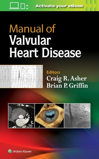 Manual of Valvular Heart Disease