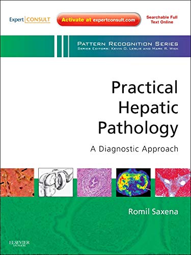 Practical Hepatic Pathology: A Diagnostic Approach