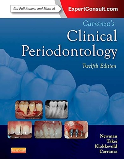 Carranza's Clinical Periodontology 12E