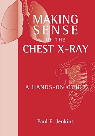 Making Sense Of The Chest X-Ray: A Hands-On Guide